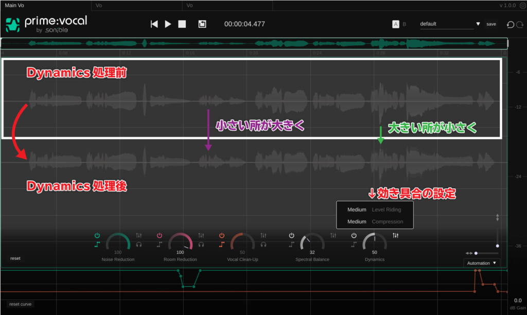 sonible prime:vocal のDynamics